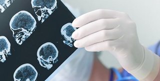 Neurología